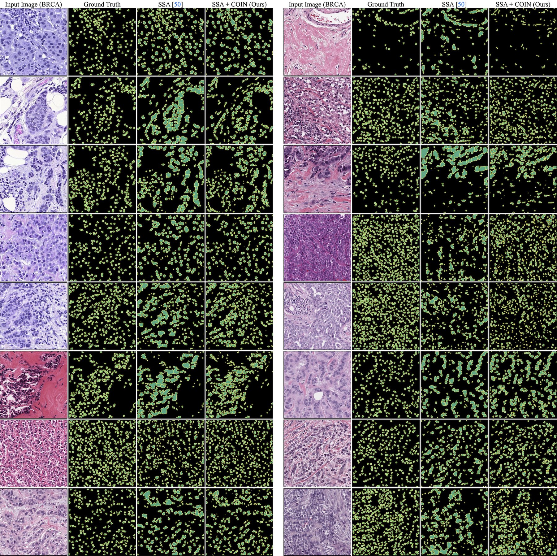 Qualitative results on BRCA