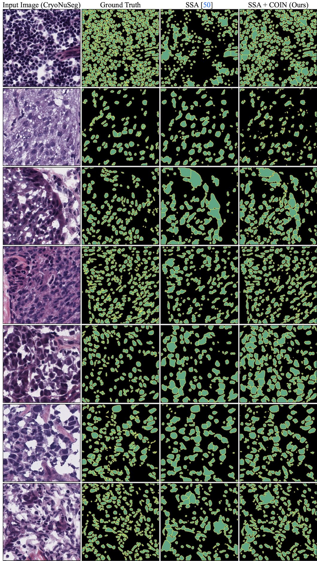 Qualitative results on CryoNuSeg