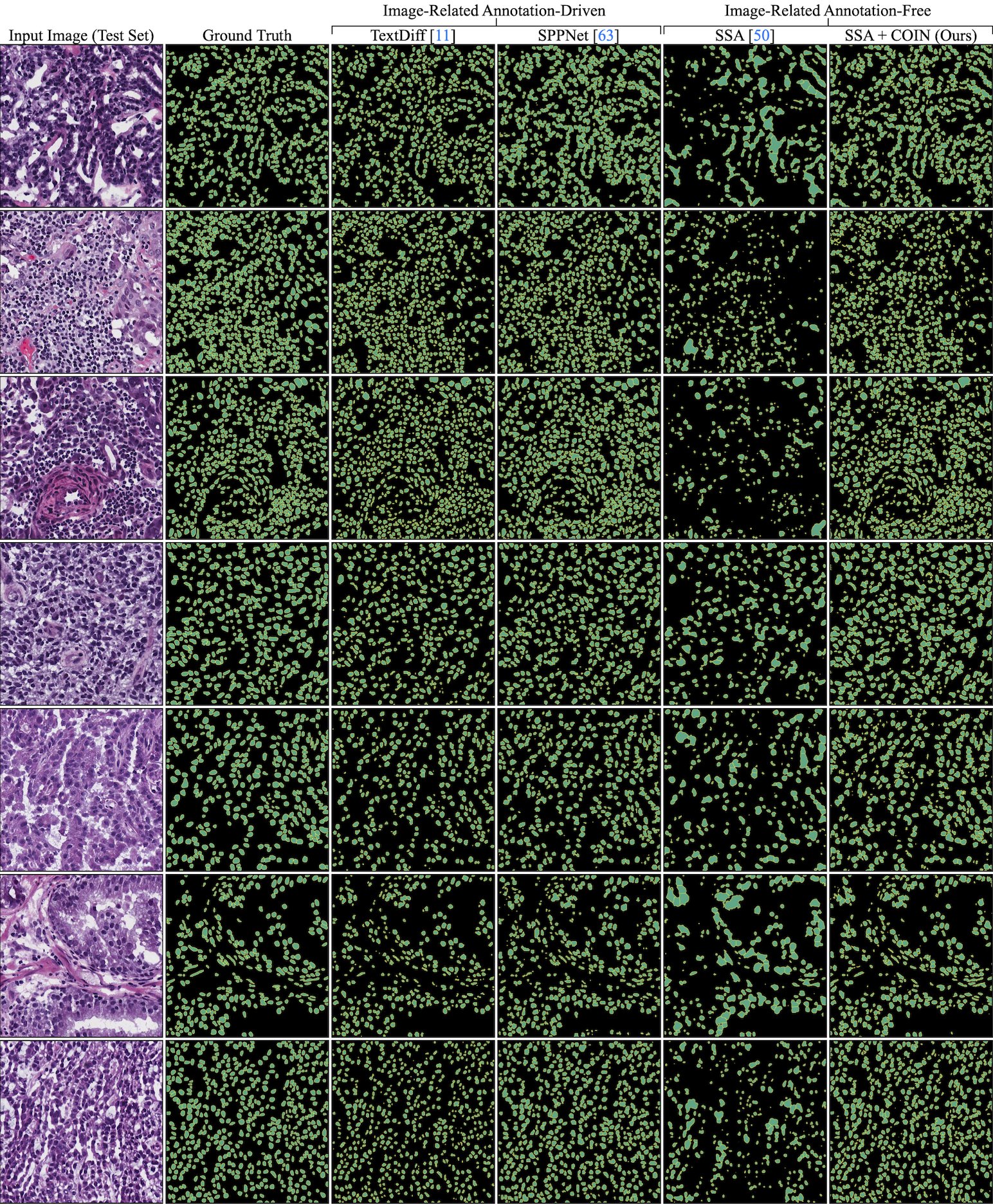 Qualitative results on MoNuSeg