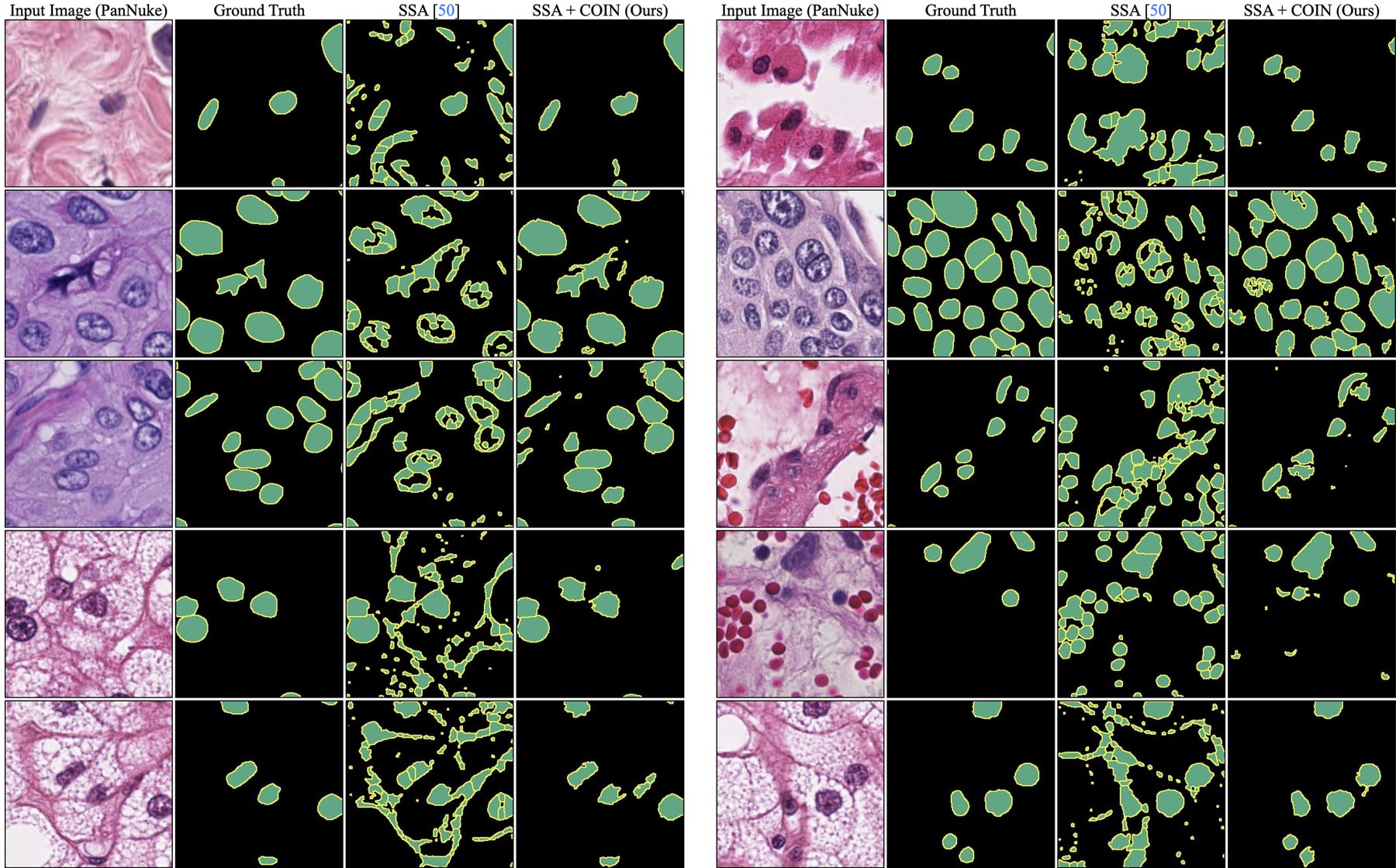 Qualitative results on PanNuke