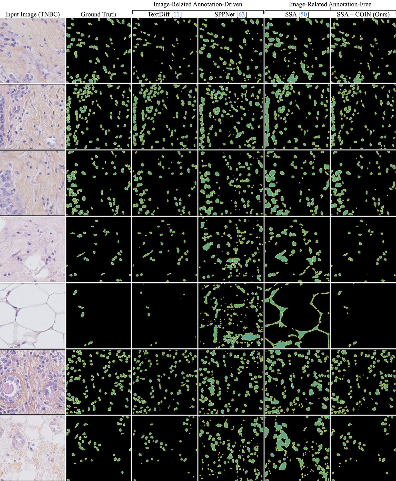Qualitative results on TNBC
