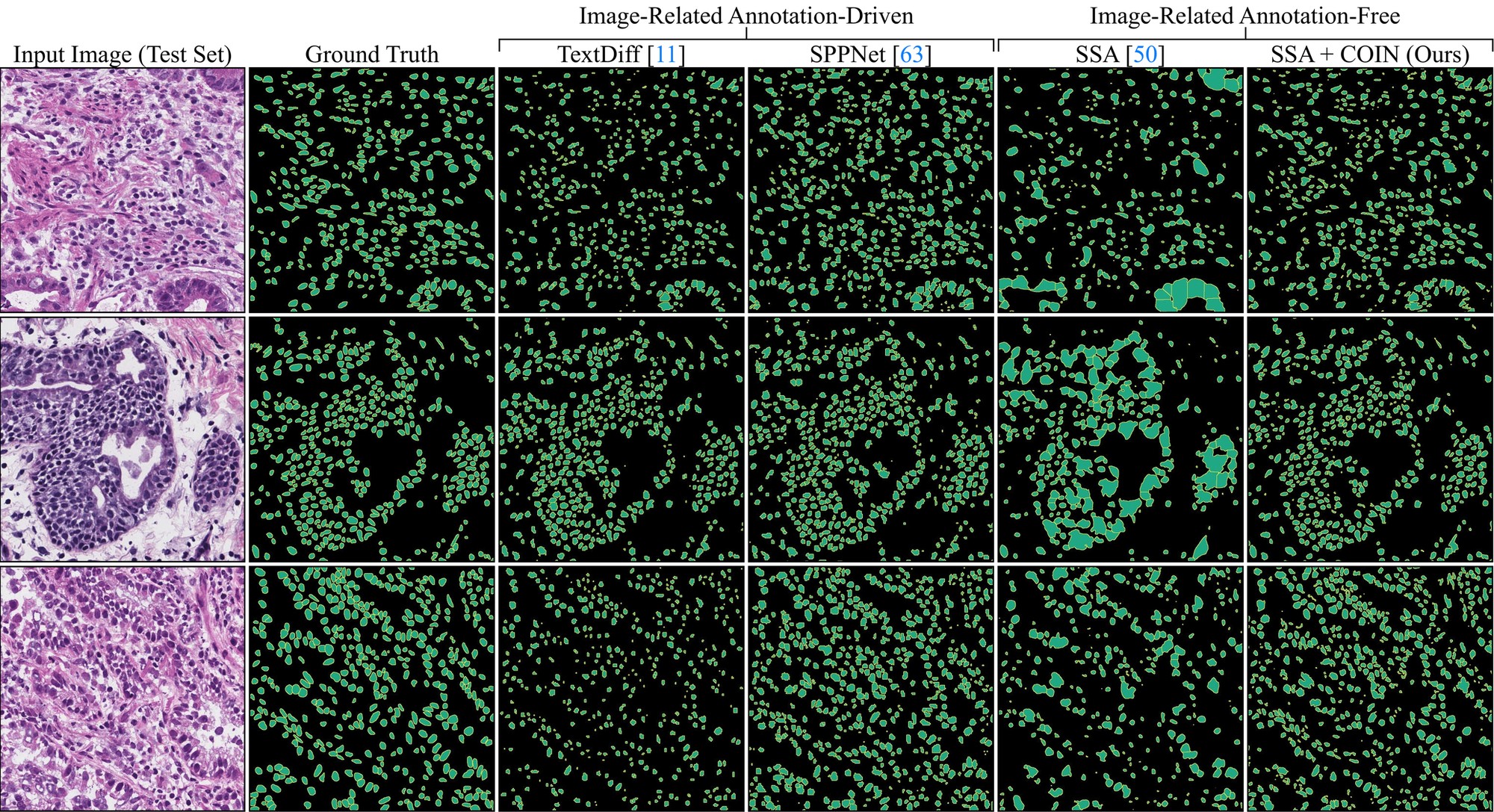 COIN headline result across cell instance segmentation benchmarks
